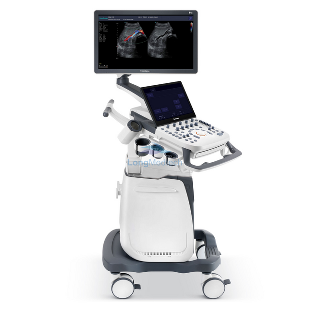 Doppler color con carro Sonoscape P25