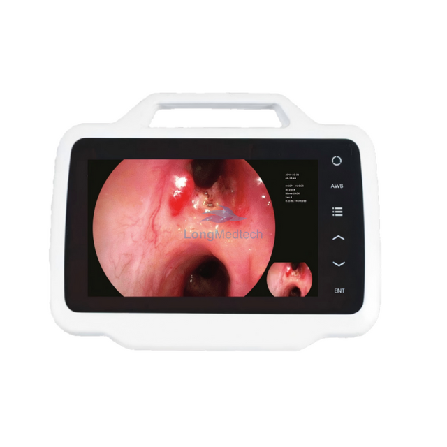 Sistema de endoscopia serie 200