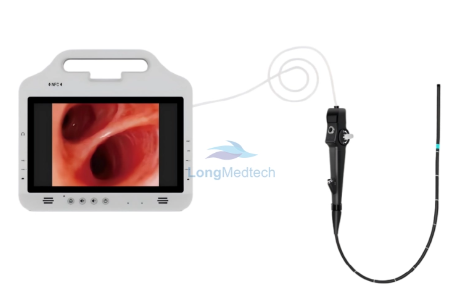 Pourquoi chaque clinique a besoin d'un vid&eacute;o-laryngoscope