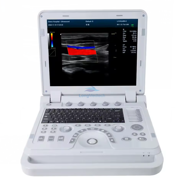 Equipo de ultrasonido port&aacute;til/dispositivo de diagn&oacute;stico ultras&oacute;nico Doppler color