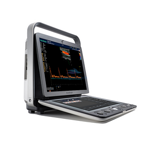 Sonoscape S9 Doppler couleur portable