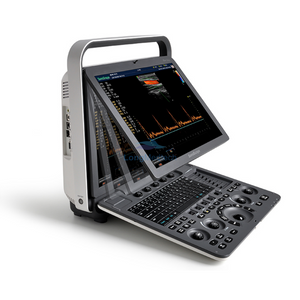 Sonoscape S8 Exp Doppler couleur portable