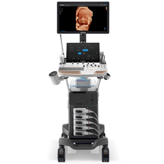 SonoScape P60 Intelligence Articul&eacute;